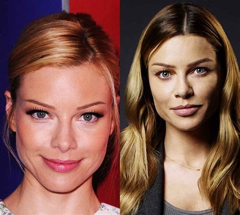 lauren german botox